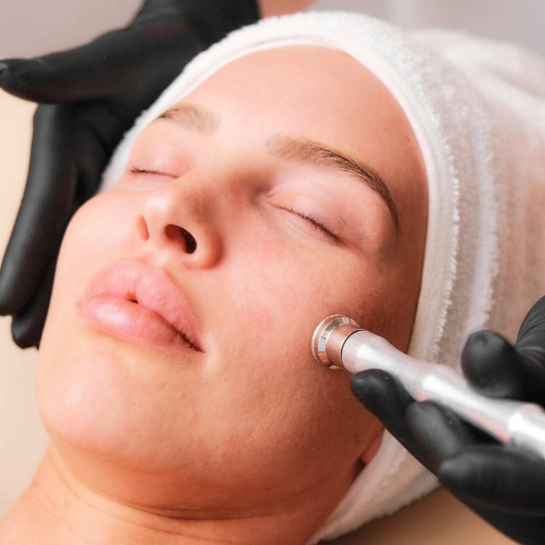 MicrodermabrasionGurbetcosmeticsKosmetikstudioHannover.png