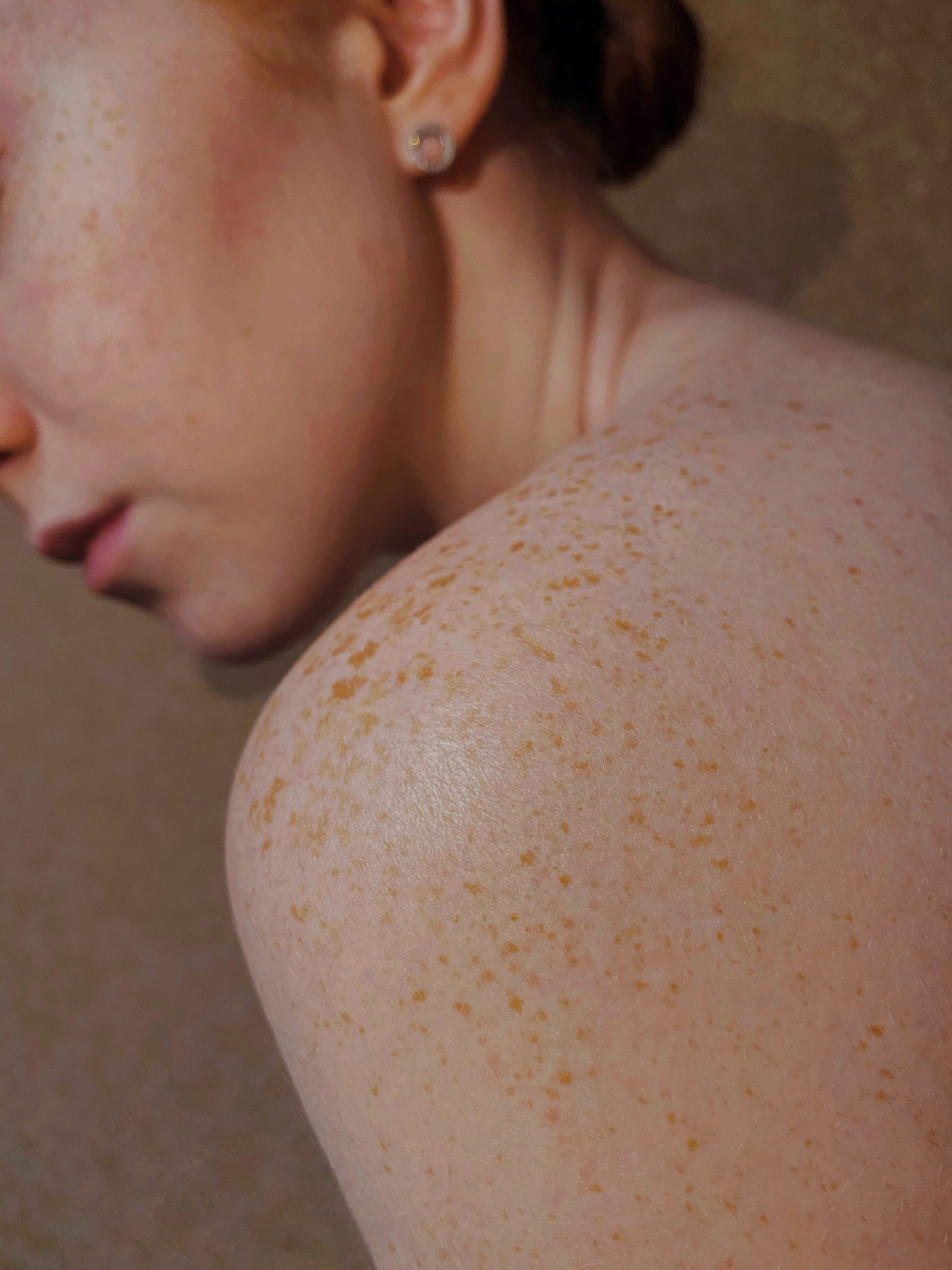 schuppige_Haut_ist_ein_Anzeichen_von_trockener_Haut_Gurbetcosmetics.jpg